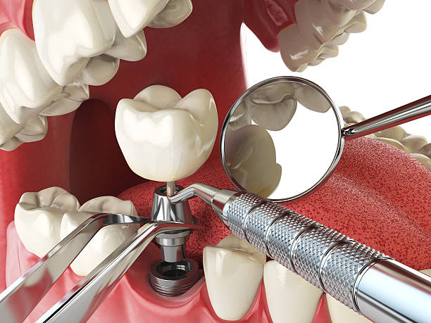 Best Dentist for Tooth Abscess  in South Rockwood, MI